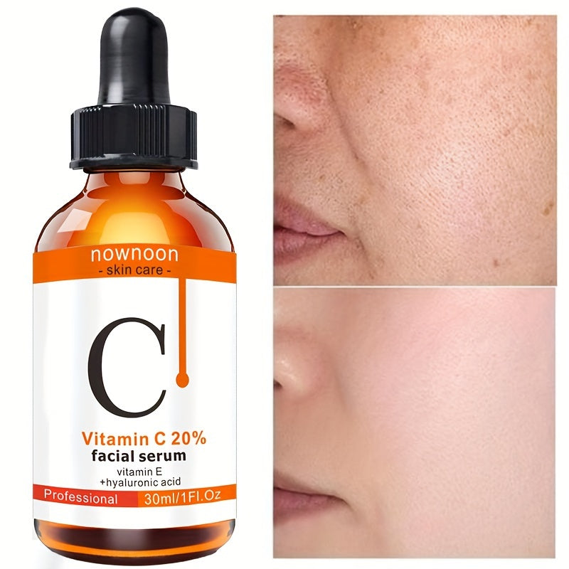 Vitamin C Face Serum - Dark Spot Remover Facial Serum 30ml