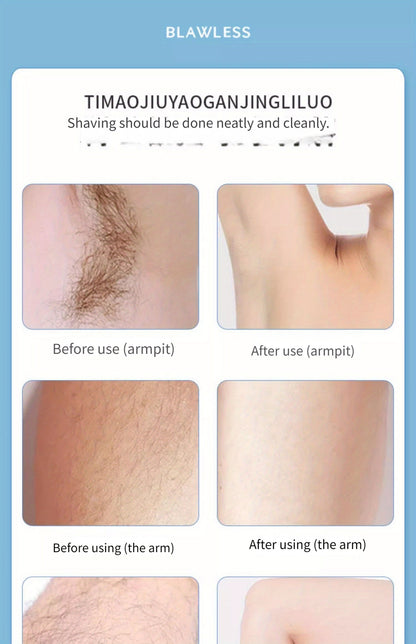 3-in-1 Electric Hair Removal Kit For Women