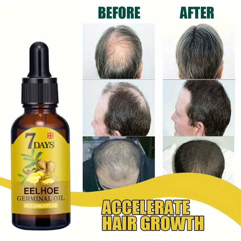 Ginger Hair Care Essential Oil