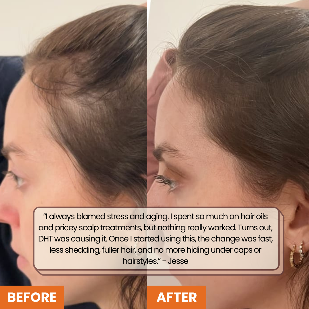 Pumpkin Seed Oil Capsules